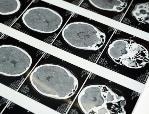 Understanding Dementia: What Families Need to Know in the First Year